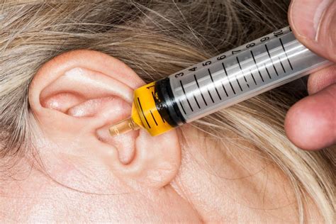 ¿Por qué se tapan los oídos? Remedios caseros para el cerumen y más