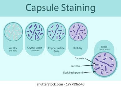 Capsule Stain Images, Stock Photos & Vectors | Shutterstock