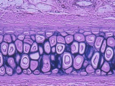 Cartilage Histology - Elastic cartilage - histology slide