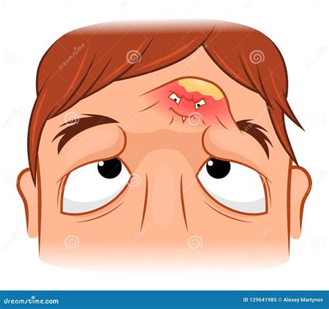 Pimple Stock Illustrations – 2,163 Pimple Stock Illustrations, Vectors ...