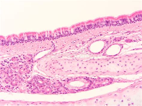 Histology of Trachea Human Tissue Stock Photo - Image of microscope ...