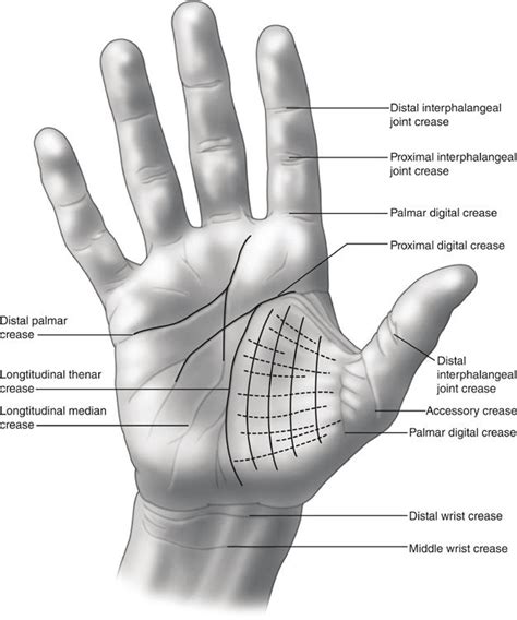 1 Palmar creases of the hand and wrist | Download Scientific Diagram