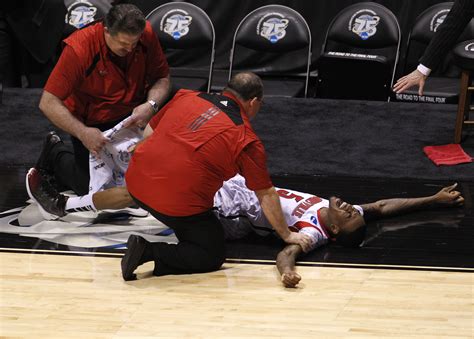 Kevin Ware Injury VIDEO, Close-up Leg Break & X-Ray PHOTOS From ...