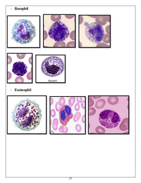 Urine analysis & Hematology Slides