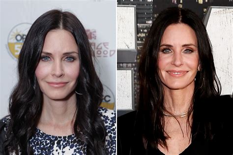 Botox before and after: Which celebrities have had Botox from Courteney Cox to Tulisa | POLYCOM ...