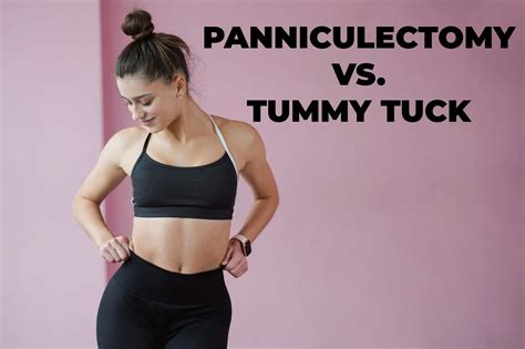 Panniculectomy vs. Tummy Tuck - Plastic Surgery in Mexico