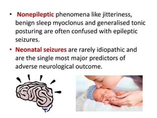 Neonatal seizures | PPT