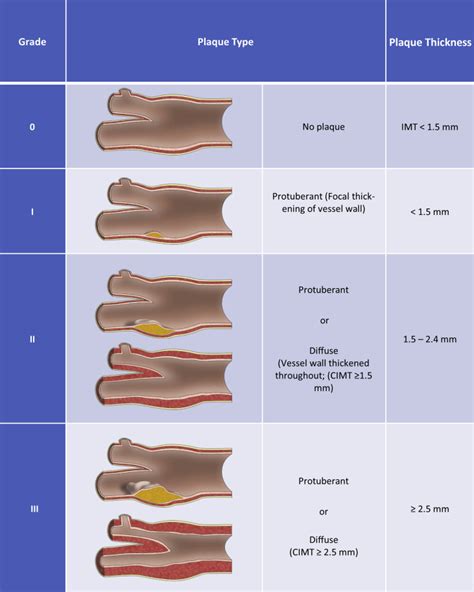 Recommendations for the Assessment of Carotid Arterial Plaque by ...