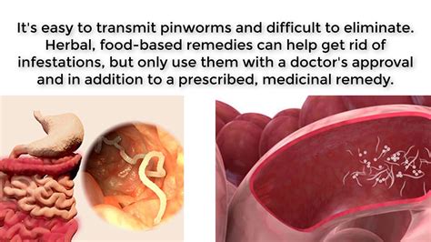 get rid of pinworms : How to Treat Pinworms || Ways To Treat Human Pinworms - YouTube