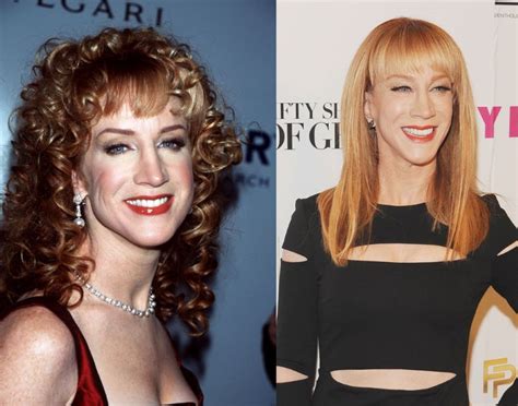 Kathy Griffin before and after plastic surgery (1) – Celebrity plastic surgery online