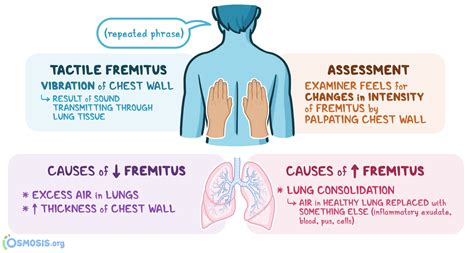 Tactile Fremitus: What Is It, How Is It Assessed | Osmosis