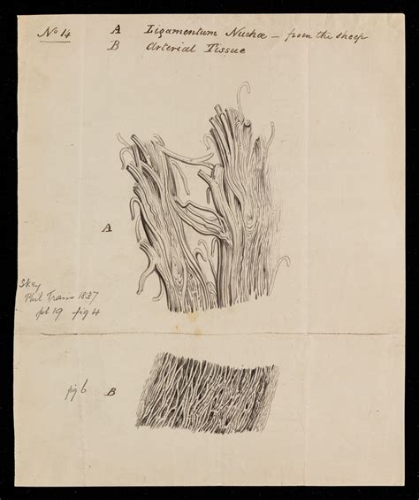 Drawings, ligamentum nuchae of sheep and artery by [Frederic Carpenter Skey?] | The Royal ...