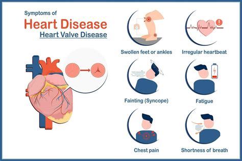 Medical illustration vector concept,symptoms of heart disease caused by heart valve disease ...