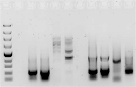 Molecular Biology Laboratory Techniques - HubPages