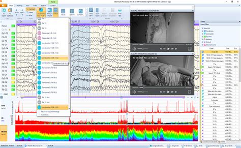 EEG System Solutions – Mitsar :: Neurodiagnostics ...