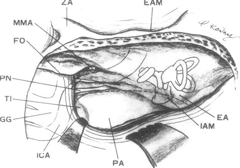 Surgical anatomy of the right pyramidal bone by the anterior ...