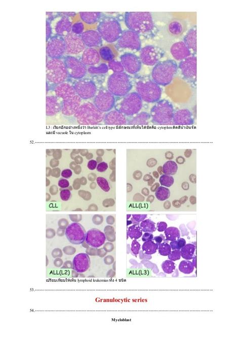 Peripheral Blood Smear Staining Procedure