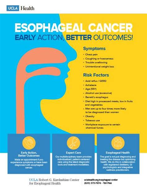 Esophageal Cancer - Esophageal Health | UCLA Health