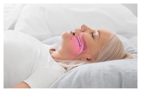 Sleep Apnea: Everything You Need to Know - Sleep Authority