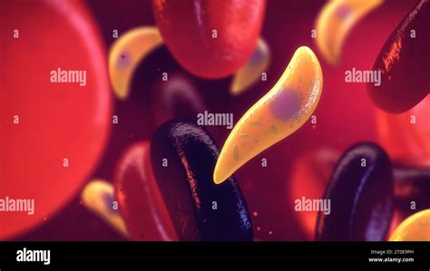 Toxoplasma Gondii tachyzoites in the blood. Toxoplasmosis infection is caused by single cell ...