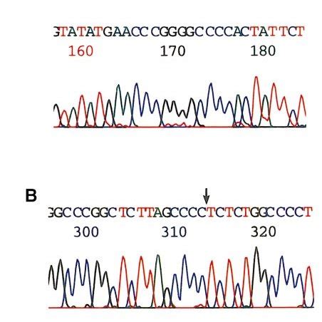 (A) Direct sequence of exon 1 in the region surrounding codon 9,... | Download Scientific Diagram