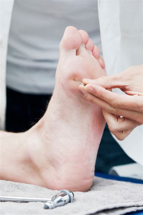 What is Out-toeing? Causes, Symptoms and Best treatment – Bilt Labs