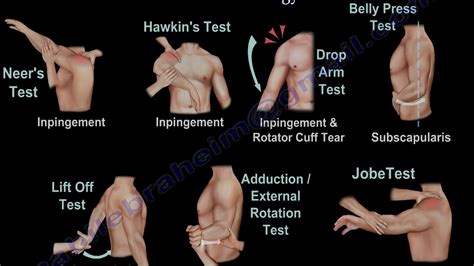 Belly Press Test Shoulder - Moshe-has-Carney