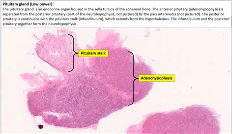 Brain – Pituitary – NUS Pathweb :: NUS Pathweb