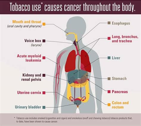 See the List of Cancers Caused by Smoking - Nigerian Health Blog