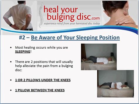 Bulging Disc Treatment | Dr. Ron Daulton, Jr. Discusses 3 Helpful Bulging Disc Treatments - YouTube