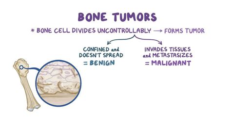 Chondroblasts: What Are They, Function, and More | Osmosis