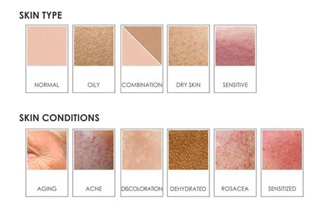 SKIN TYPES & CONDITIONS – leaderma