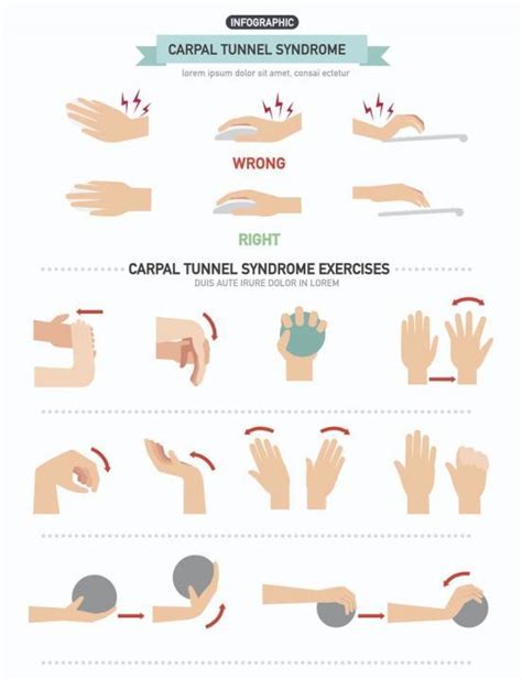 Understanding Carpal Tunnel Syndrome - Symptoms and Prevention – All ...