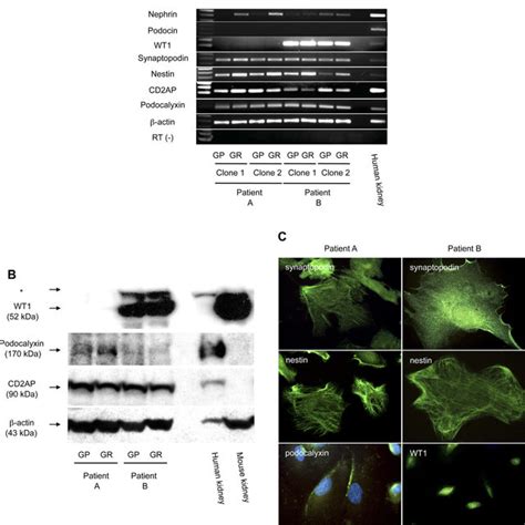 Proliferating primary urinary cells display podocyte markers. Urinary ...