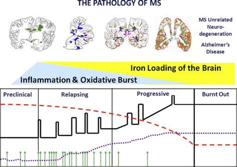 The pathology of multiple sclerosis changes with time. In the early... | Download Scientific Diagram