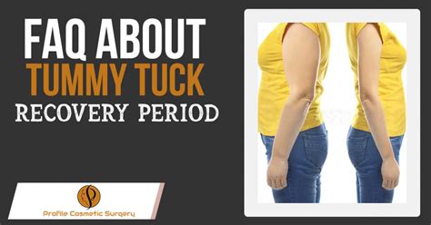 FAQ About Tummy Tuck Recovery Period – Blog – Profile Studios