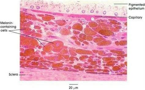 Choroid | Histología