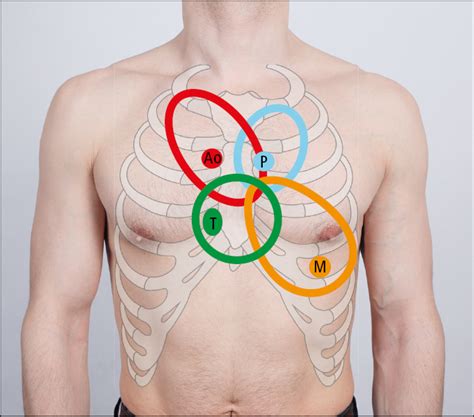 Soplos cardíacos - Auscultación cardíaca - Síntomas y signos - Medicina Interna Basada en la ...