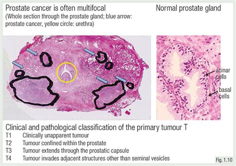 Prostate Gland Histology