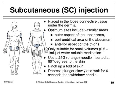 Subcutaneous Injection Technique