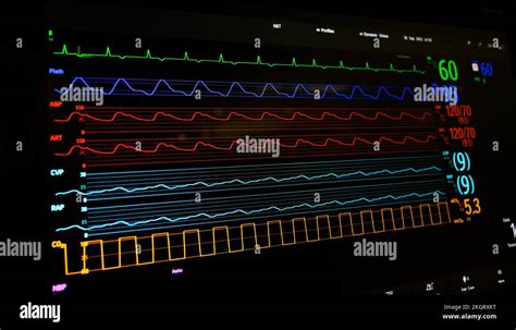 Screen of a bedside patient monitor in an English hospital Stock Photo - Alamy