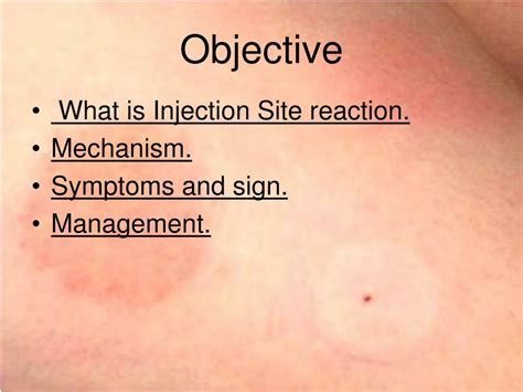 PPT - Injection Site Reaction PowerPoint Presentation, free download - ID:3111753