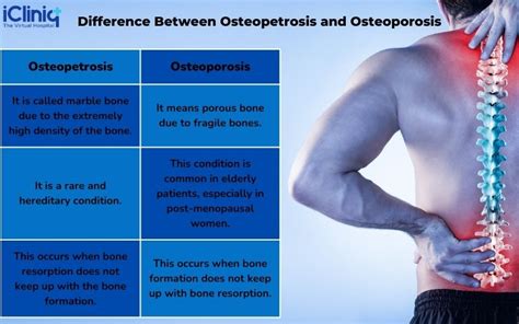 What Is Osteopetrosis?