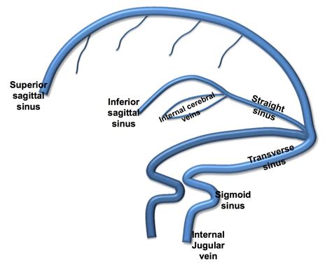 Cerebral Venous Thrombosis: Pearls and Pitfalls - emdocs