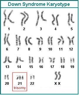 Human Chromosomal Abnormalities: Autosomal Abnormalities