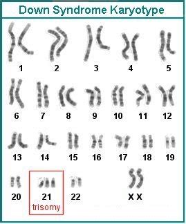 Human Chromosomal Abnormalities: Autosomal Abnormalities