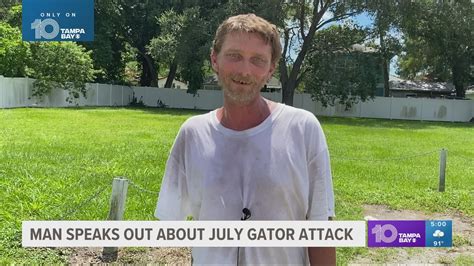 Florida man loses his arm to a gator swimming across a lake | wtsp.com