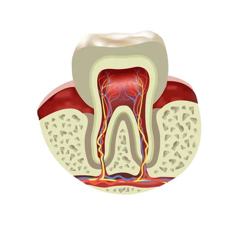 Internal structure of tooth (decay and caries) — Stock Vector ...