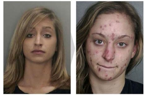 18 Disturbing Before And After Pictures Of Faces Transformed By Drug Abuse | LifeCrust