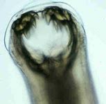 Hookworm